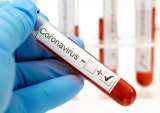 Can A Startup Fill The Coronavirus Testing Gap?