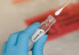 Alphabet's Verily Opens Coronavirus Test Lab